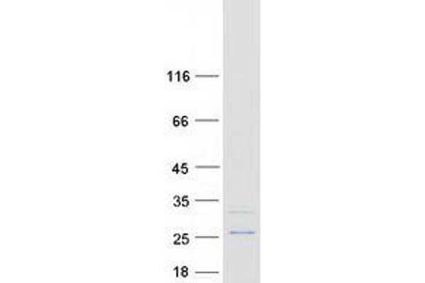 COQ10B Protein (Myc-DYKDDDDK Tag)