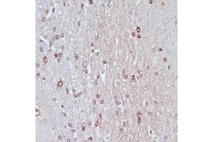 Immunohistochemistry of paraffin-embedded rat brain using TPD52 antibody  at dilution of 1:100 (40x lens). (TPD52 antibody  (AA 1-184))