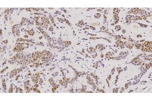 Immunohistochemistry (IHC) image for anti-Estrogen Receptor 1 (ESR1) antibody (ABIN7538886) (Estrogen Receptor alpha antibody)