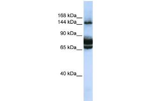 WB Suggested Anti-FAM83B Antibody Titration: 0. (FAM83B antibody  (C-Term))