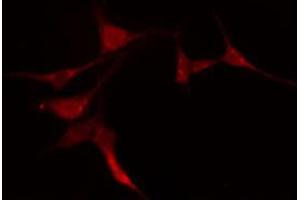 ABIN6274200 staining COLO205 cells by IF/ICC. (PRKACG antibody)