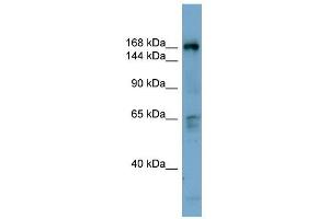 Western Blot showing DOCK2 antibody used at a concentration of 1-2 ug/ml to detect its target protein. (DOCK2 antibody  (Middle Region))