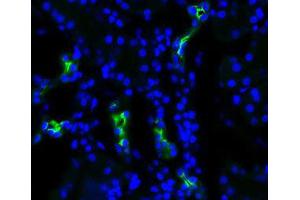 Aquaporin 2 Immunofluorescence. (AQP2 antibody  (C-Term))