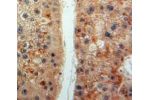 Used in DAB staining on fromalin fixed paraffin-embedded Liver tissue (Prekallikrein antibody  (AA 156-364))