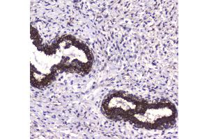 IHC analysis of MAP1LC3A using anti-MAP1LC3A antibody . (MAP1LC3A antibody  (AA 1-120))