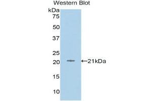 Western Blotting (WB) image for anti-L1 Cell Adhesion Molecule (L1CAM) (AA 526-690) antibody (ABIN1859587) (L1CAM antibody  (AA 526-690))