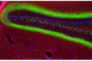 Immunohistochemistry (IHC) image for anti-Actin, beta (ACTB) (AA 2-16) antibody (ABIN1742508)