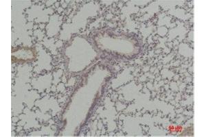 Immunohistochemistry (IHC) analysis of paraffin-embedded Mouse Lung Tissue using Cyclin D1 Rabbit Polyclonal Antibody diluted at 1:200. (Cyclin D1 antibody)