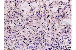 Formalin-fixed and paraffin embedded mouse kidney tissue labeled Anti-Vimentin Polyclonal Antibody, Unconjugated (ABIN672786) at 1:200, followed by conjugation to the secondary antibody and DAB staining (Vimentin antibody  (AA 371-466))