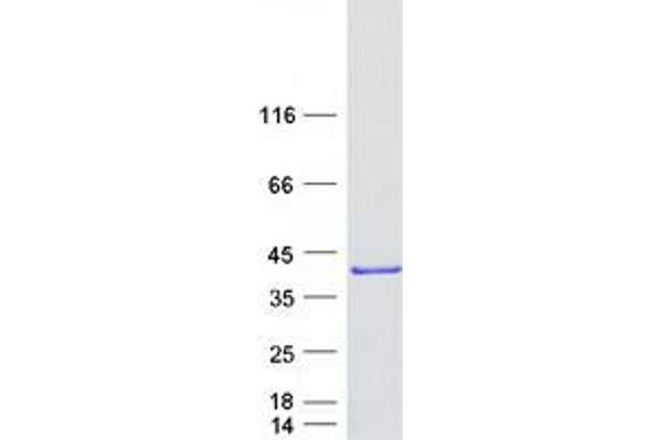 HMGCLL1 Protein (Transcript Variant 2) (Myc-DYKDDDDK Tag)