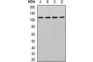 Western blot analysis of WDR6 expression in Hela (A), HepG2 (B), mouse brain (C), mouse liver (D) whole cell lysates. (WDR6 antibody)