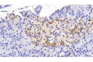 Detection of Slit2 in Human Pancreas Tissue using Polyclonal Antibody to Slit Homolog 2 (Slit2) (SLIT2 antibody  (AA 664-777))