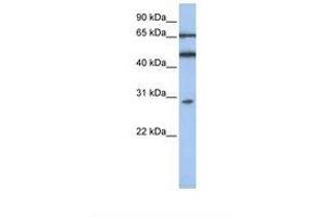 Image no. 1 for anti-Interferon-Induced Protein with Tetratricopeptide Repeats 5 (IFIT5) (AA 110-159) antibody (ABIN6739018) (IFIT5 antibody  (AA 110-159))