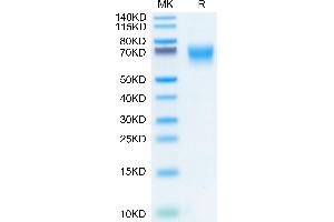 Human FGFR2 alpha (IIIc) on Tris-Bis PAGE under reduced conditions. (FGFR2 alpha (AA 22-377) protein (His tag))