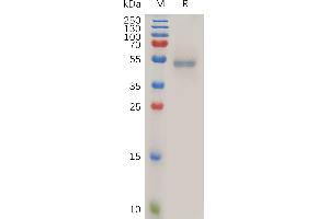 Human FASLG Protein, N-hFc Tag on SDS-PAGE under reducing condition. (FASL Protein (Fc Tag))