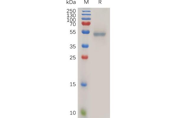 FASL Protein (Fc Tag)