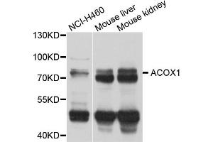 Western blot analysis of extracts of various cell lines, using ACOX1 antibody (ABIN5975699) at 1/1000 dilution. (ACOX1 antibody)