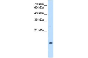 PPIA antibody used at 2. (PPIA antibody)