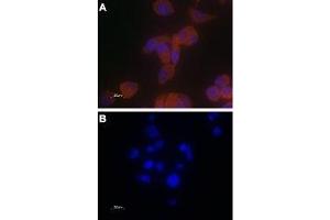 Expression of TRPV6 in PC-3 cells - Immunocytochemical staining of paraformaldehyde-fixed PC-3 cells with Anti-TRPV6 Antibody (ABIN7043857, ABIN7043998 and ABIN7043999), (1:100) followed by goat anti-rabbit-AlexaFluor-555 secondary antibody (A) or with a mixture of Anti-TRPV6 Antibody and TRPV6 peptide antigen (1:20) (B). (TRPV6 antibody  (C-Term, Intracellular))