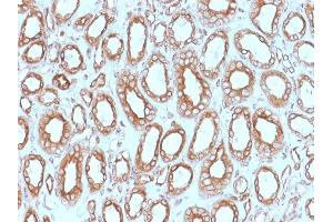 Formalin-fixed, paraffin-embedded human Renal Cell Carcinoma stained with Calnexin Mouse Monoclonal Antibody (CANX/1543). (Calnexin antibody  (N-Term))