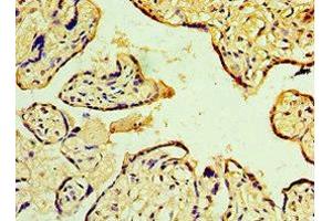 Immunohistochemistry of paraffin-embedded human placenta tissue using ABIN7150705 at dilution of 1:100 (MAP2K3 antibody  (AA 1-170))