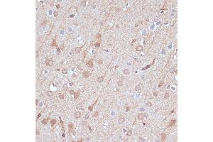 Immunohistochemistry of paraffin-embedded rat brain using  antibody (ABIN7265470) at dilution of 1:100 (40x lens). (Adenylate Kinase 5 antibody  (AA 150-370))