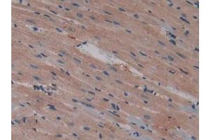 DAB staining on IHC-P; Samples: Mouse Heart Tissue (Talin antibody  (AA 975-1181))