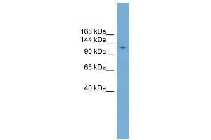 LIG1 antibody used at 1 ug/ml to detect target protein. (LIG1 antibody  (Middle Region))