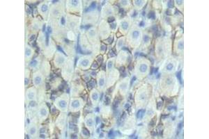 Used in DAB staining on fromalin fixed paraffin- embedded Kidney tissue (IL22R antibody  (AA 242-485))