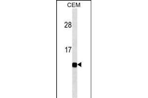 B2M Antibody ABIN1539902 western blot analysis in CEM cell line lysates (35 μg/lane). (beta-2 Microglobulin antibody  (AA 10-39))
