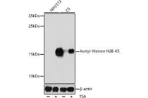 Western blot analysis of extracts of various cell lines, using Acetyl-Histone H2B-K5 antibody (ABIN7267733) at 1:1000 dilution. (Histone H2B antibody  (acLys5))