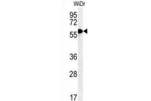 Western Blotting (WB) image for anti-TRAF Family Member-Associated NFKB Activator (TANK) antibody (ABIN3002470) (TANK antibody)