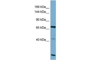 Host:  Rabbit  Target Name:  OCA2  Sample Type:  OVCAR-3 Whole cell lysates  Antibody Dilution:  1. (OCA2 antibody  (C-Term))