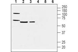 Western blot analysis of mouse heart membranes (lanes 1 and 4), mouse lung lysate (lanes 2 and 5) and rat lung membranes (lanes 3 and 6): - 1-3. (Prostacyclin Receptor antibody  (3rd Extracellular Loop))