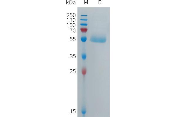 CPM Protein (AA 18-422) (His tag)