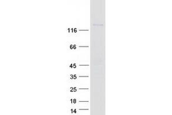 CD103 Protein (Myc-DYKDDDDK Tag)