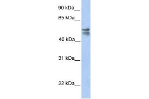 TRMU antibody used at 1 ug/ml to detect target protein. (TRMU antibody  (C-Term))