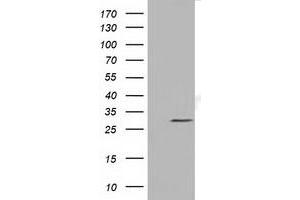 HEK293T cells were transfected with the pCMV6-ENTRY control (Left lane) or pCMV6-ENTRY NSMCE2 (Right lane) cDNA for 48 hrs and lysed. (NSMCE2 antibody)