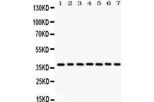 Western Blotting (WB) image for anti-Nucleophosmin (Nucleolar phosphoprotein B23, Numatrin) (NPM1) (AA 1-294) antibody (ABIN3042497) (NPM1 antibody  (AA 1-294))