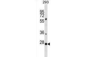 Western Blotting (WB) image for anti-Pleckstrin Homology Domain Containing, Family F (With FYVE Domain) Member 1 (PLEKHF1) antibody (ABIN2998808) (PLEKHF1 antibody)