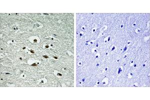 Immunohistochemistry analysis of paraffin-embedded human brain tissue using Chk1 (Phospho-Ser296) antibody. (CHEK1 antibody  (pSer296))