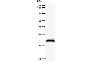 Western Blotting (WB) image for anti-ATP-Dependent RNA Helicase A (DHX9) antibody (ABIN932191) (DHX9 antibody)