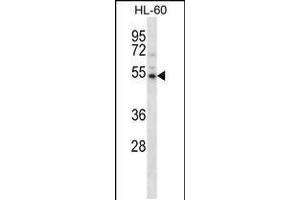 Western blot analysis in HL-60 cell line lysates (35ug/lane). (CAMKV antibody  (N-Term))