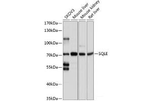 Western blot analysis of extracts of various cell lines using SQLE Polyclonal Antibody at dilution of 1:1000. (SQLE antibody)