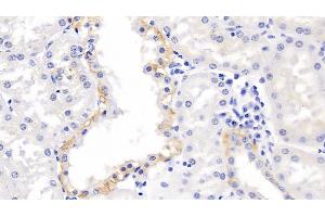 Detection of MMP3 in Human Kidney Tissue using Polyclonal Antibody to Matrix Metalloproteinase 3 (MMP3) (MMP3 抗体  (AA 247-370))