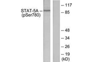 Western Blotting (WB) image for anti-Signal Transducer and Activator of Transcription 5A (STAT5A) (pSer780) antibody (ABIN2888533) (STAT5A antibody  (pSer780))