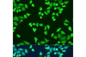 Immunofluorescence analysis of U2OS cells using SMN2 Polyclonal Antibody at dilution of 1:100. (SMN2 antibody)