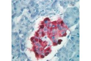 Formalin fixed paraffin embedded human pancreas stained with Chromogranin A antibody. (Chromogranin A antibody  (C-Term))