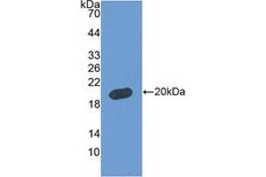 Western blot analysis of recombinant Human FBLN5. (Fibulin 5 antibody  (AA 99-205))