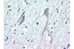 Rat Brain (Neuronal Pentraxin (AA 137-312) antibody)